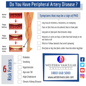artery disease