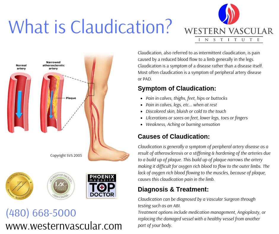 Claudication