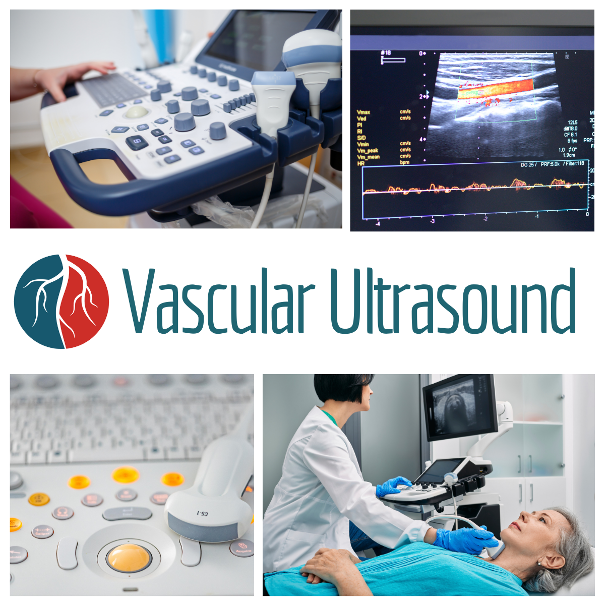 Vascular Ultrasound