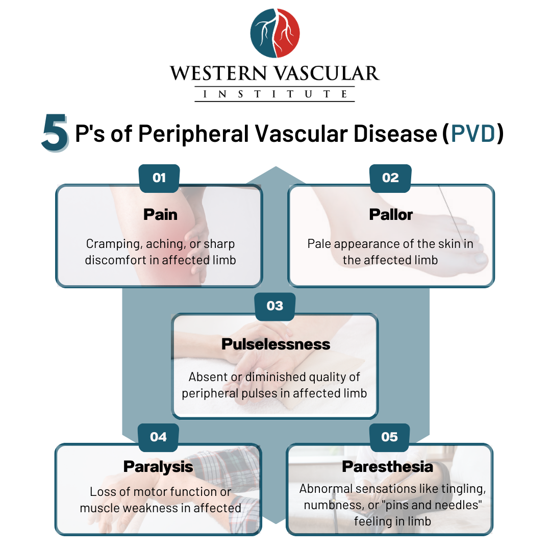 Peripheral Vascular Disease