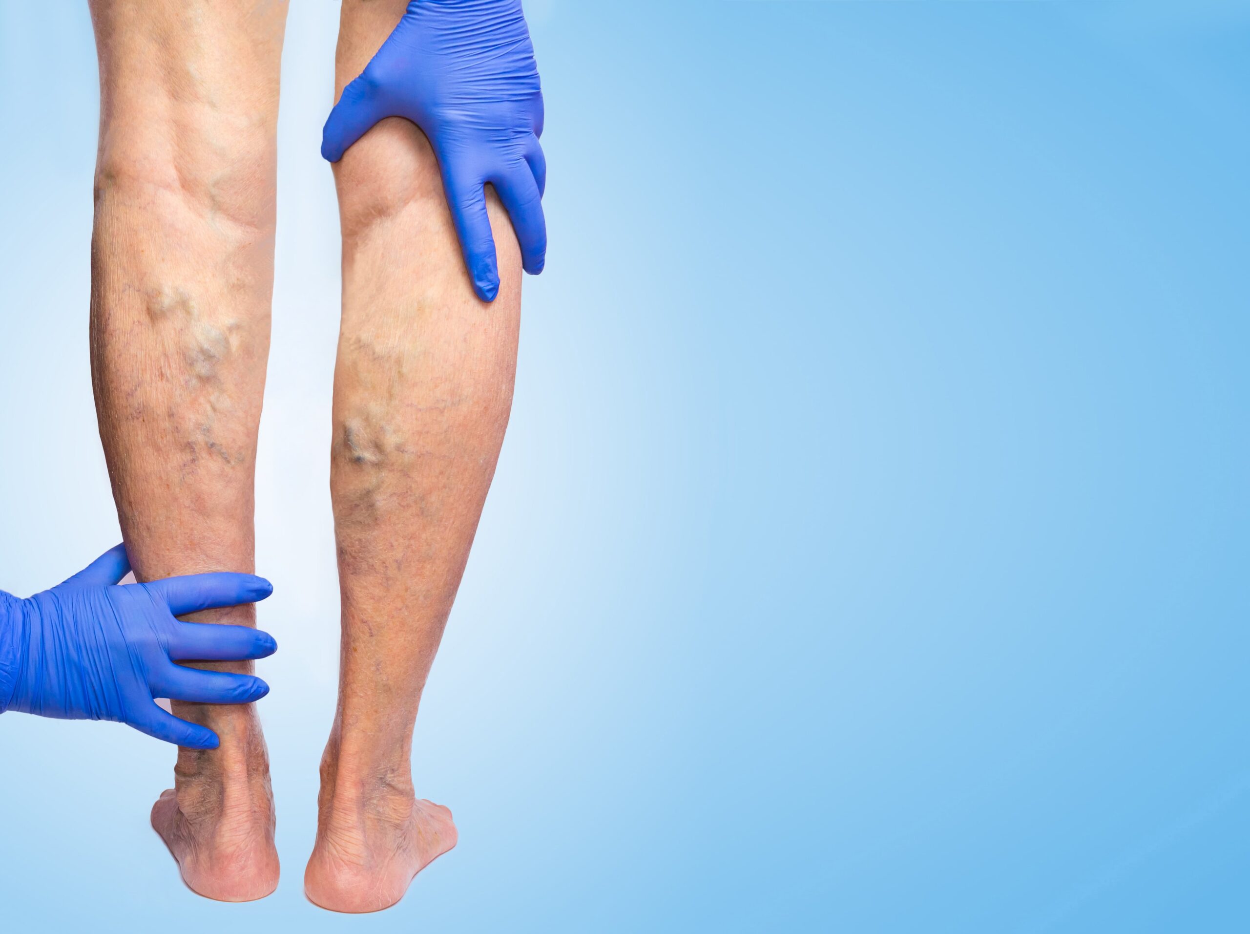 doctor examining a patients leg.